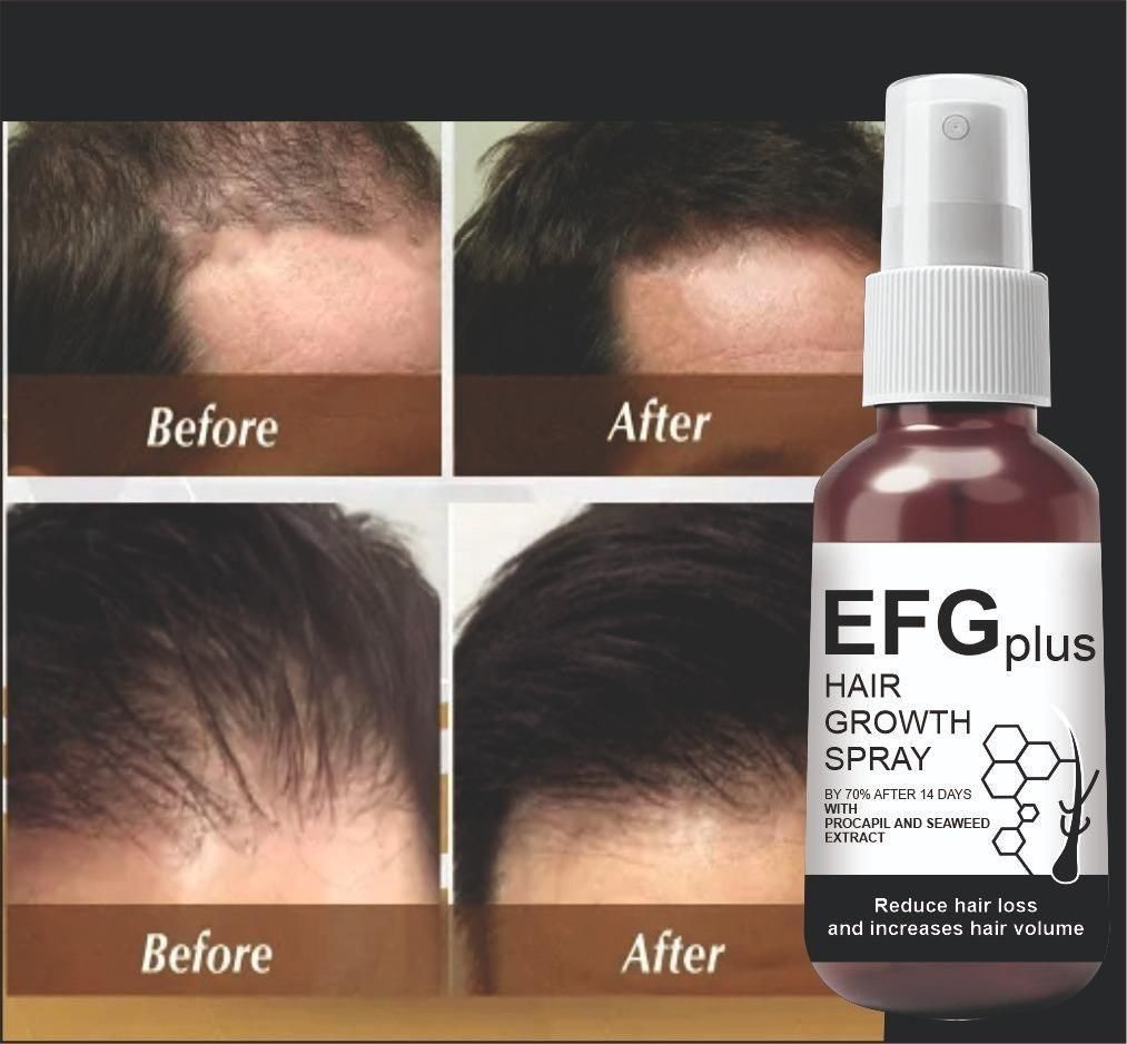 EFGPLUS Hair Growth Spray 50ml (Pack of 2)