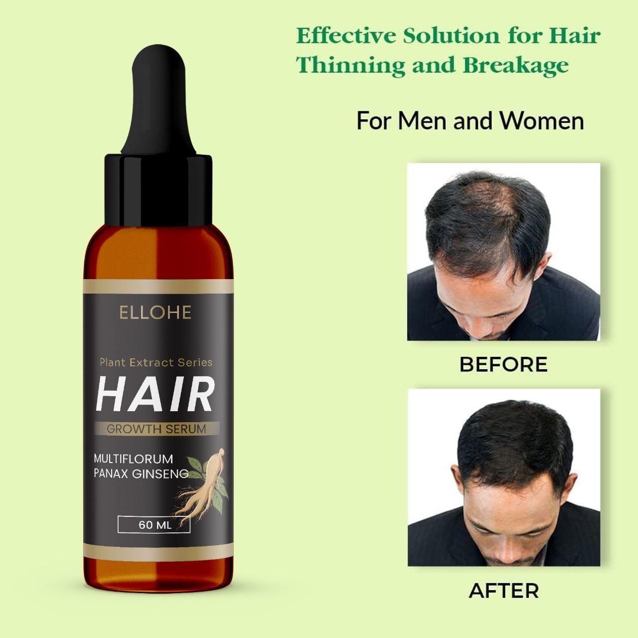 ELLOHE Plant Extract Series Hair Growth Serum 120ml Pack of 2