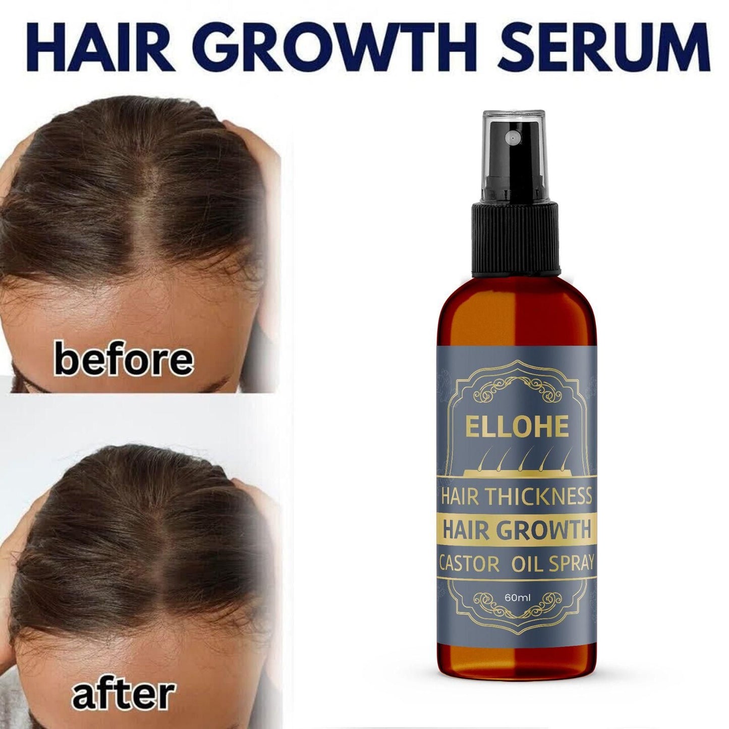 ELLOHE Hair Thickness Hair Growth Castor Oil Spray 120ml Pack of 2