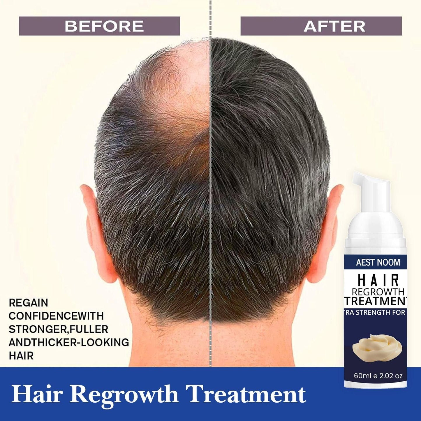 AEST NOOM Hair Regrowth Treatment Extra Strength Formula 60ml