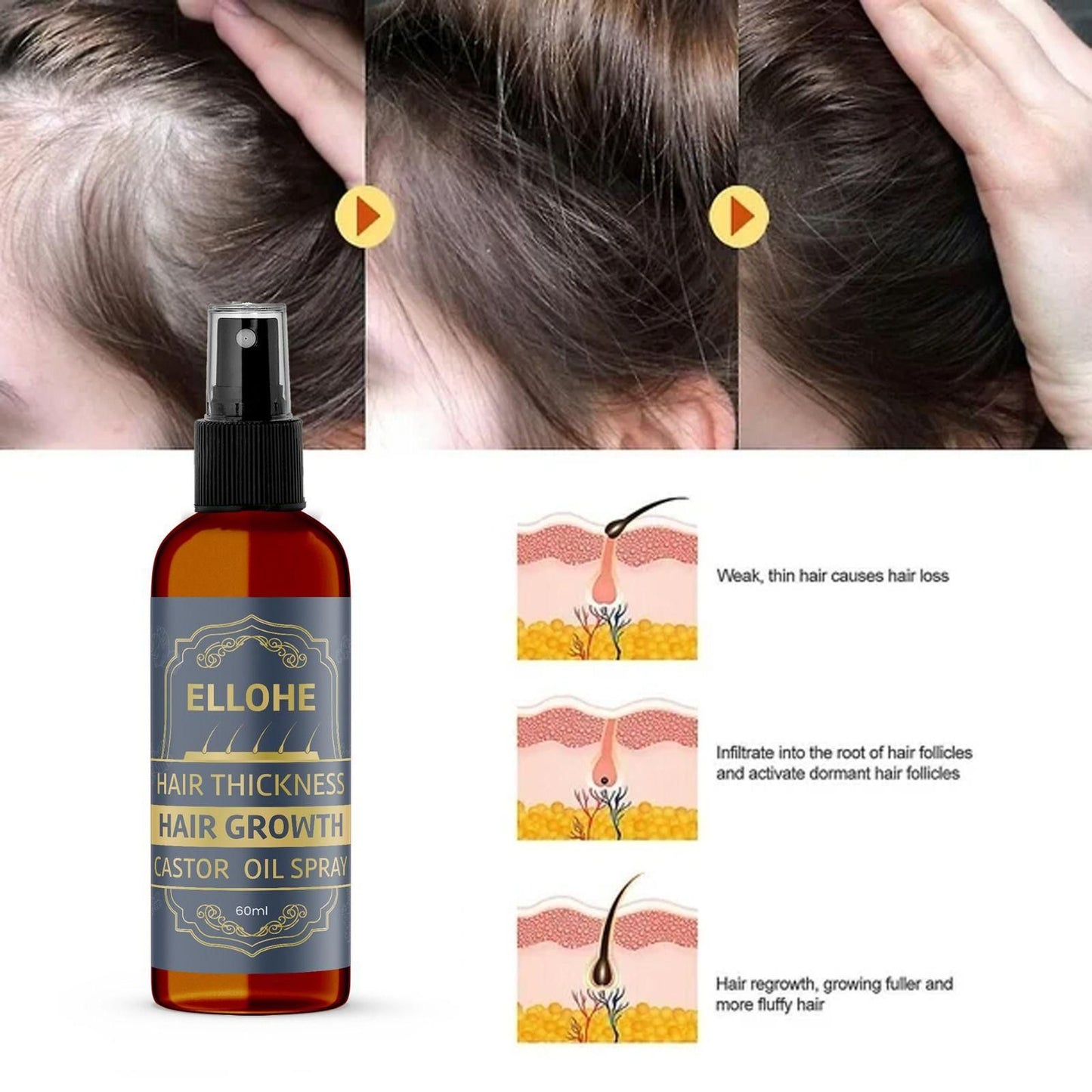 ELLOHE Hair Thickness Hair Growth Castor Oil Spray 120ml Pack of 2