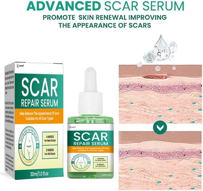 Scar Repair Serum 30ML (Pack of 2)